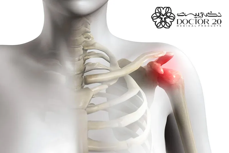 علت سندروم گیرافتادگی شانه چیست؟